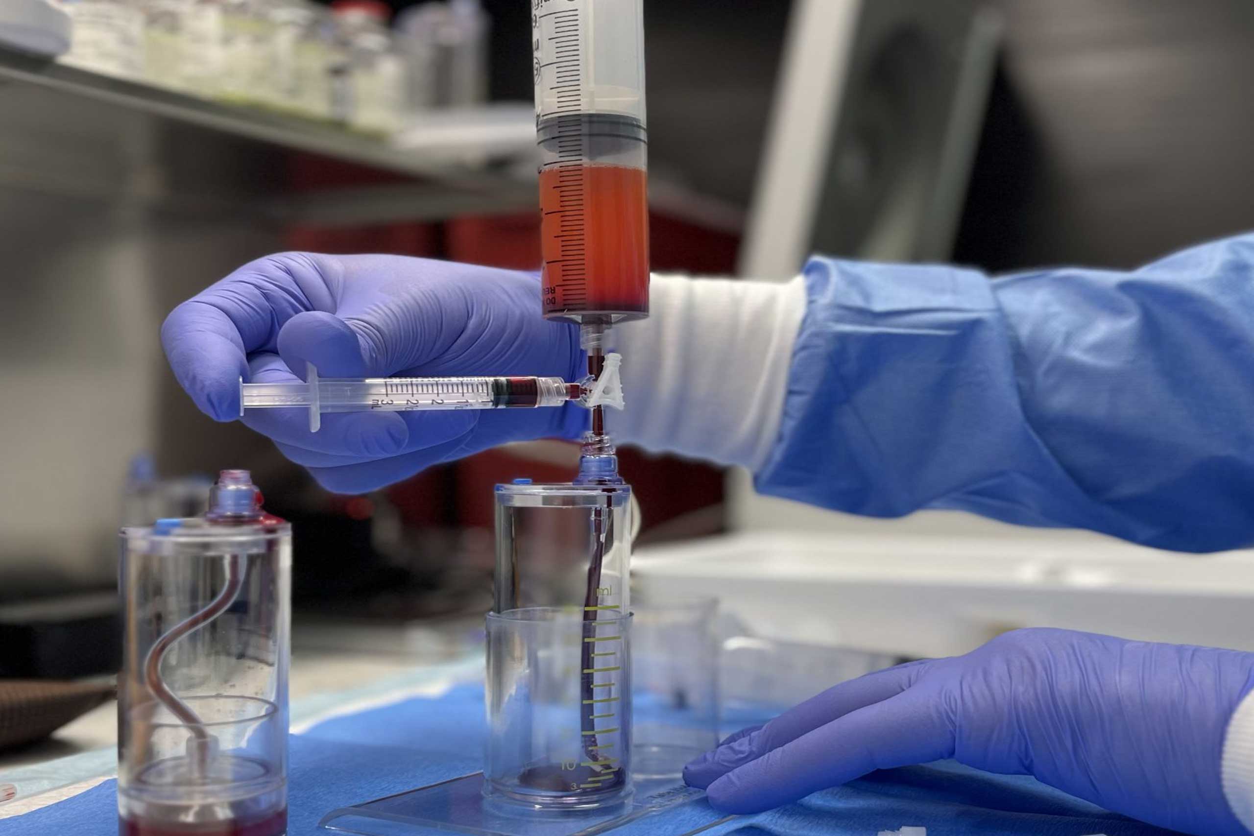 Stem Cell Therapy Chicago – Ultimate Medical Group
